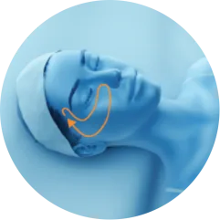 EMface facial toning Dublin - 3D head diagram showing the upper cheeks 3D head diagram showing the upper cheeks for EMface facial toning in Dublin